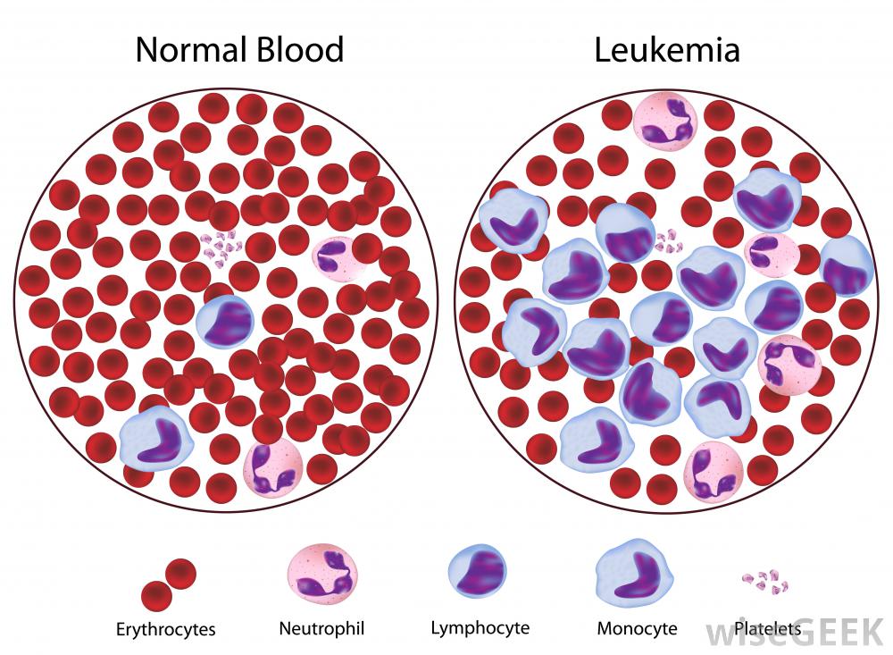 Stanford Scientists Reprogram Dangerous Cancer Cells To Immune Cells