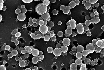 Thriving Colony Of Ancient Microbes Discovered In Antarctica's Vida Lake