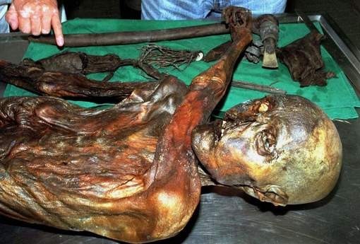 Otzi The Iceman Should Have Visited A Dentist (Or Eaten Less Junk Food)!